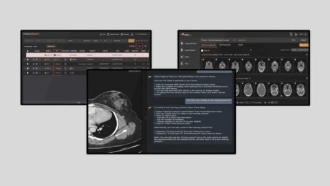 AI and Cloud based PACS