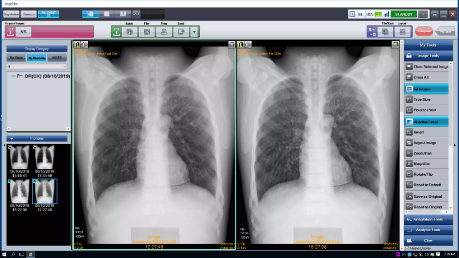 AeroDR NS Wireless Flat Panel Detector