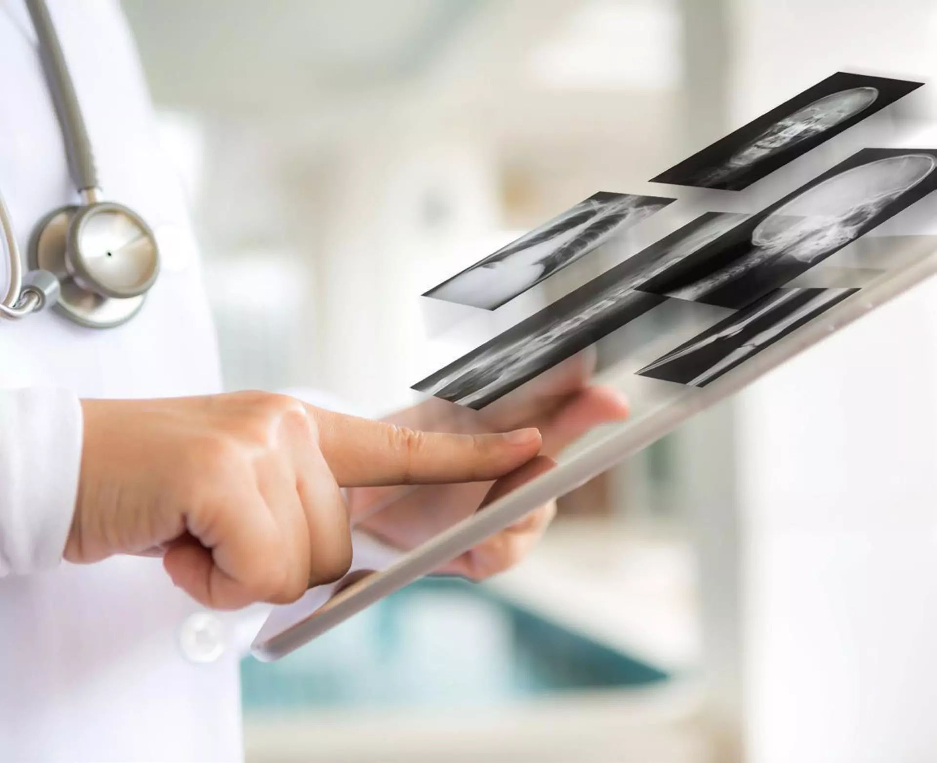 AeroDR Portable Digital Radiography Solution