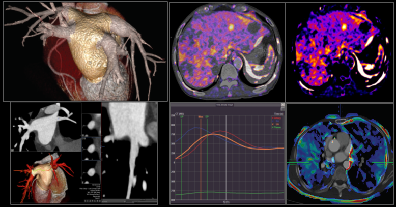 Alphenix / Evolve Edition