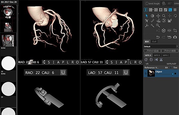Alphenix Interventional