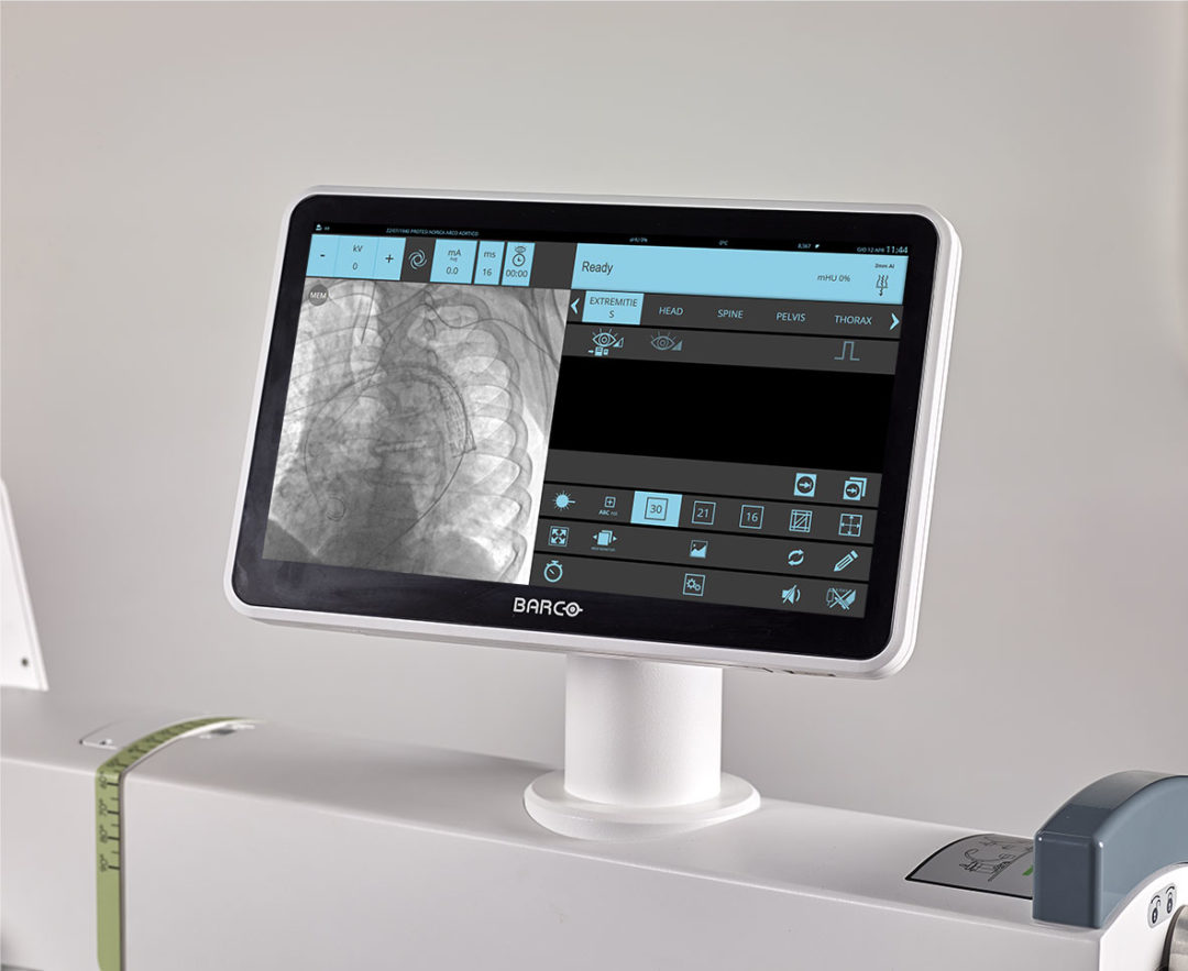 Primax Cyberbloc FP Mobile C-Arm System