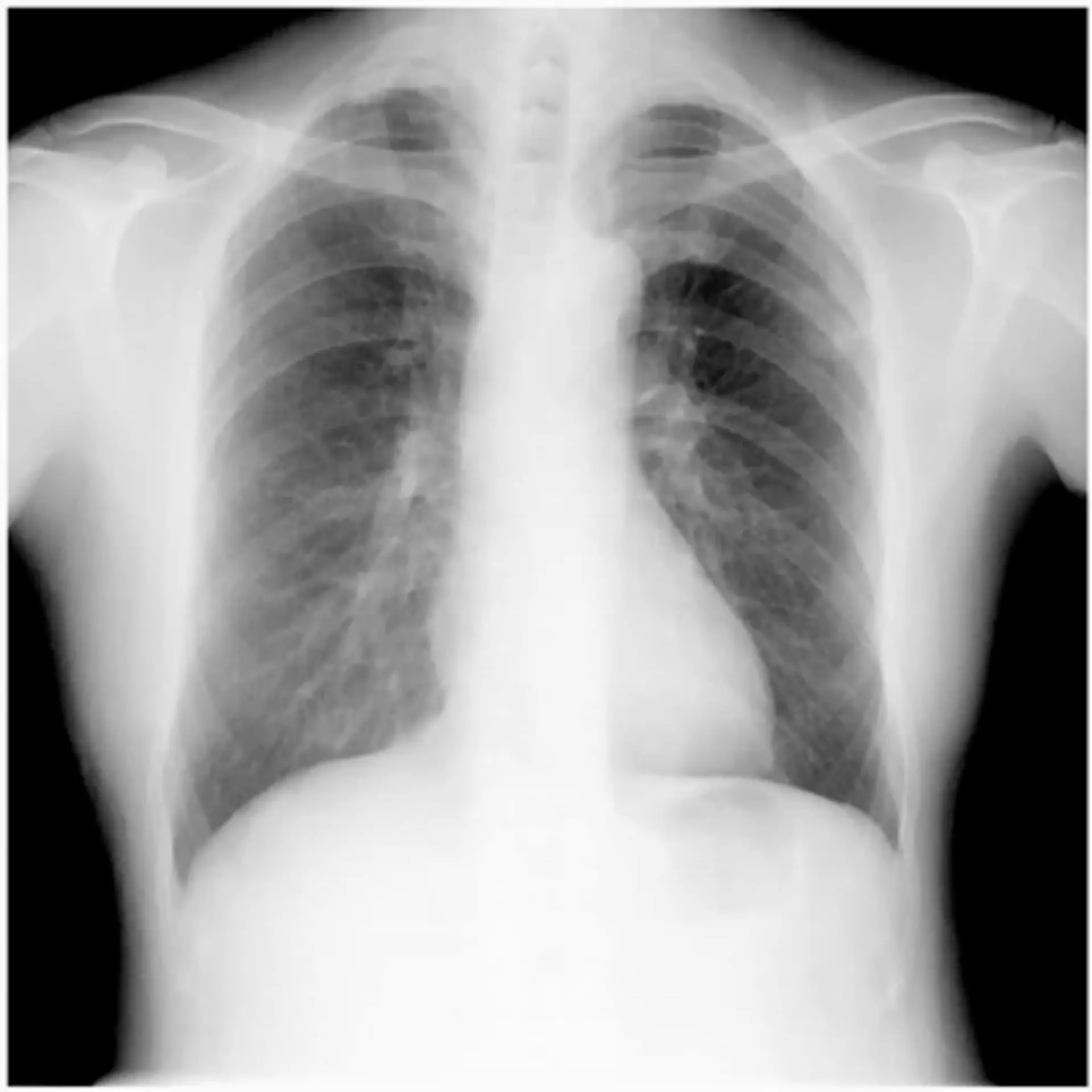 Dynamic Digital Radiography