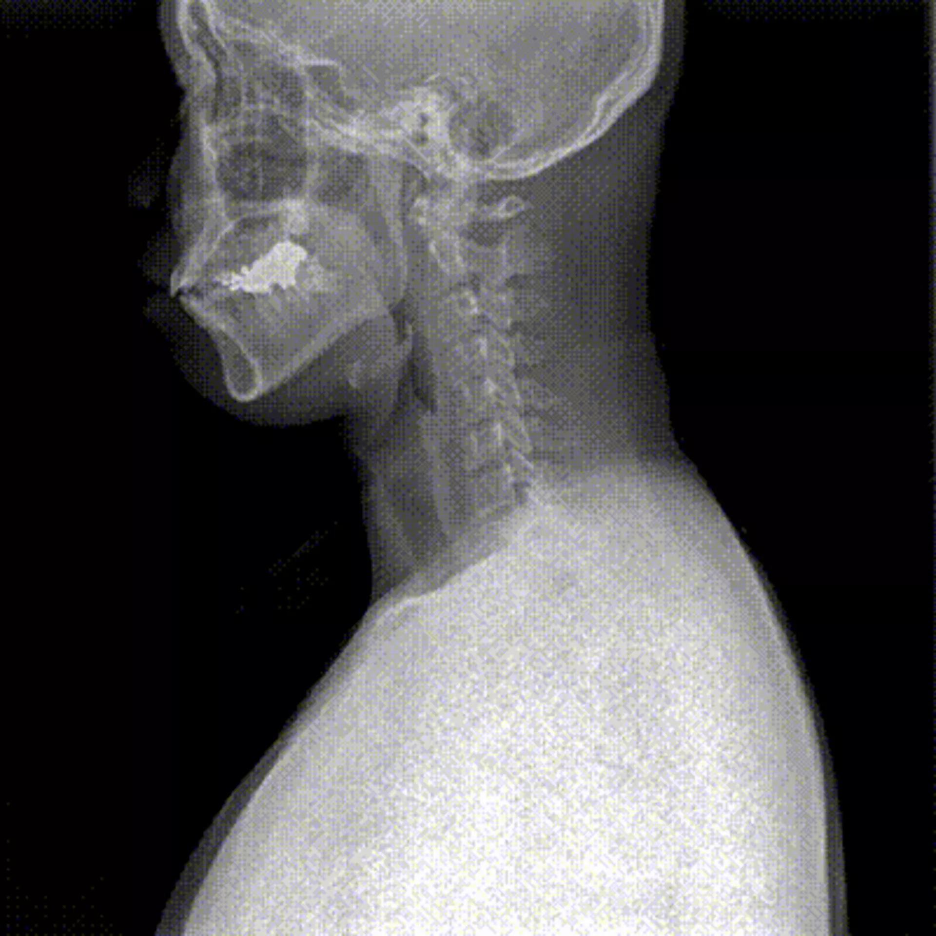 Dynamic Digital Radiography