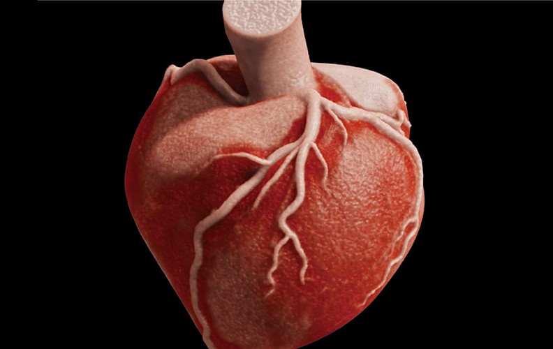 Canon Vitrea Advanced Visualization Workstation