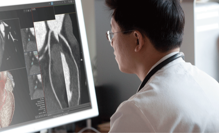 Canon Vitrea Advanced Visualization Workstation