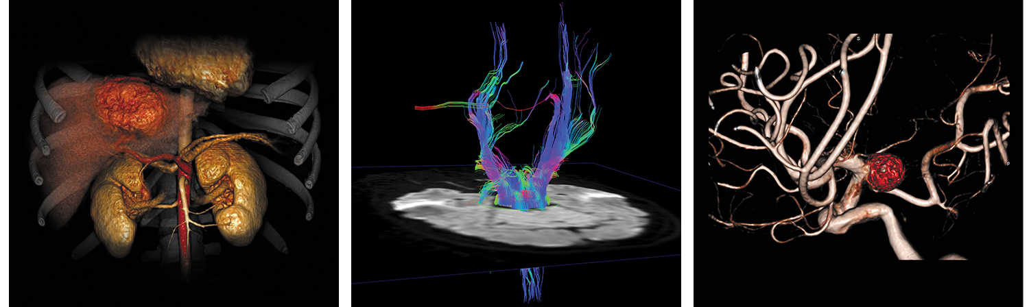 Canon Vitrea Advanced Visualization Workstation