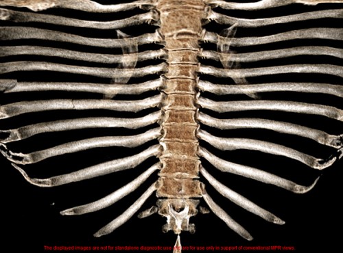 Canon Vitrea Advanced Visualization Workstation