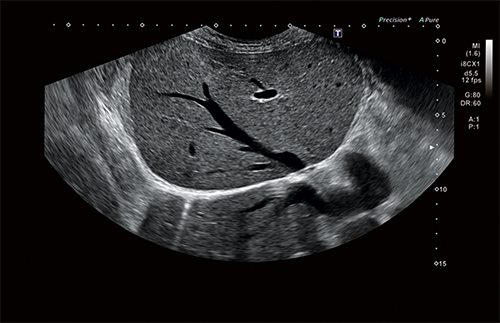 Canon Aplio i700 Ultrasound System