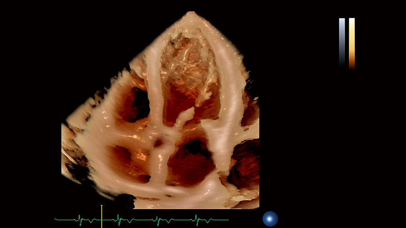 Canon Aplio i900 Ultrasound System