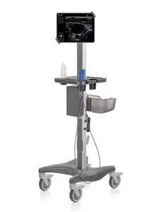 EchoNous Kosmos Ultraportable Ultrasound System